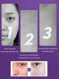 Anti-Aging Moisturizer Cream | Whitening, Hydrating & Skin Repair Face Cream for Youthful Glow