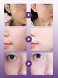 Anti-Aging Moisturizer Cream | Whitening, Hydrating & Skin Repair Face Cream for Youthful Glow