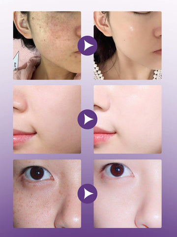 Anti-Aging Moisturizer Cream | Whitening, Hydrating & Skin Repair Face Cream for Youthful Glow